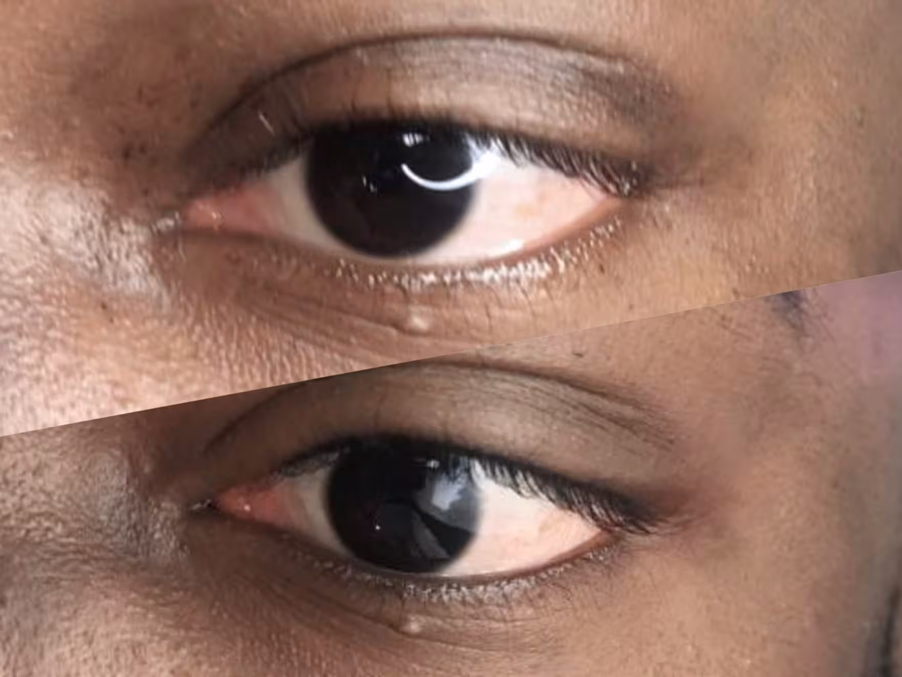 Técnica de Micropigmentação Eyeliner Especializada para Homens