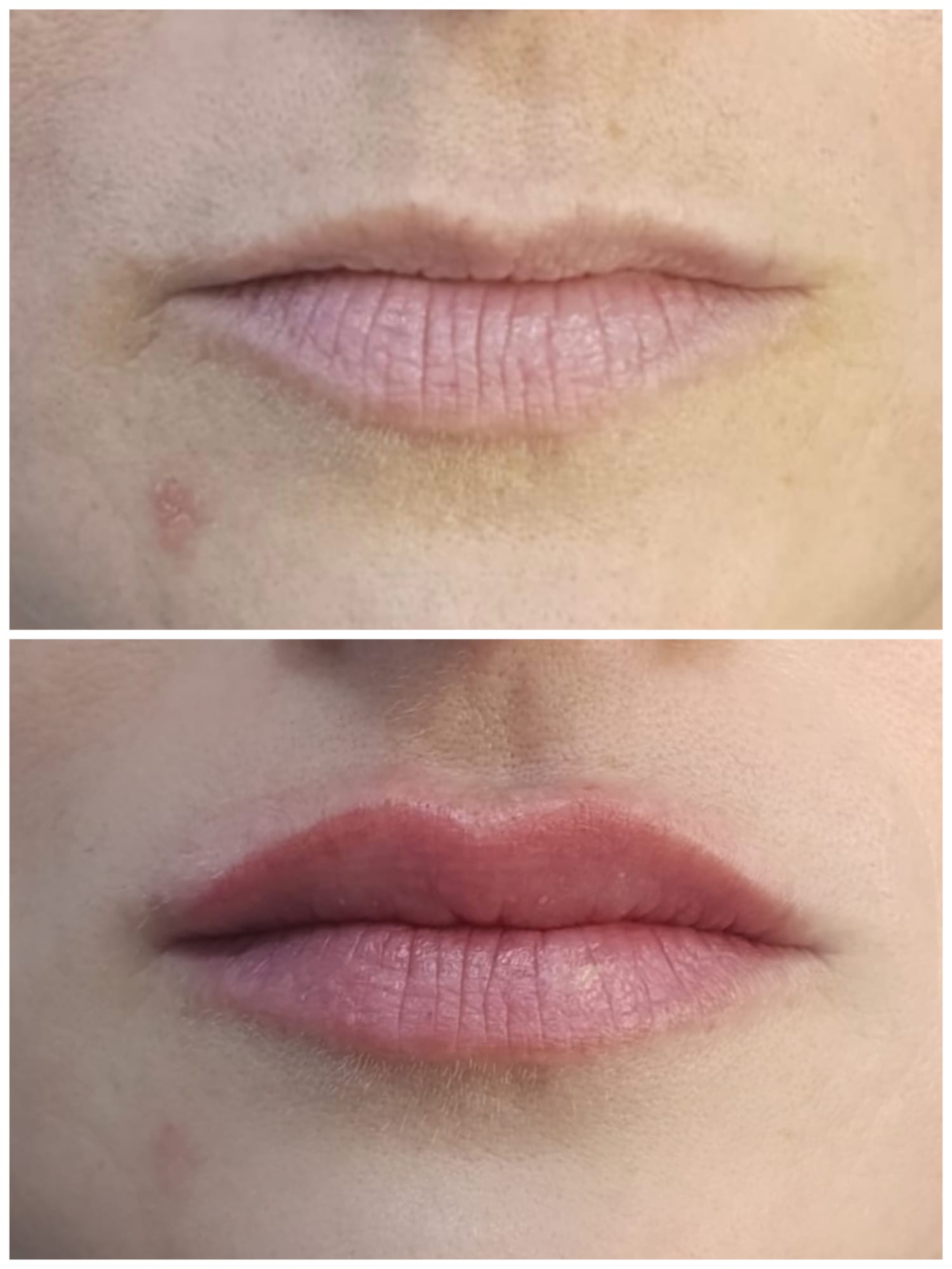 A micropigmentação labial precisa de retoque